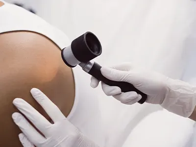 Atendimentos Clínicos Dermatológicos