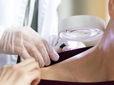 Análise de Lesões de Pele